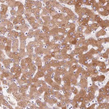Anti-LPA antibody produced in rabbit, 100 µL (HPA060604-100UL)