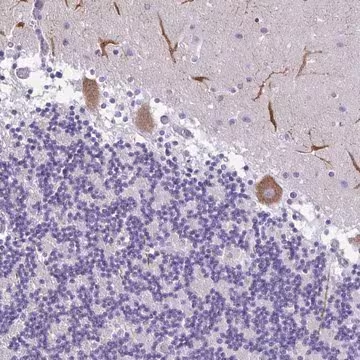Anti-PAK3 antibody produced in rabbit, 100 µL (HPA060219-100UL)