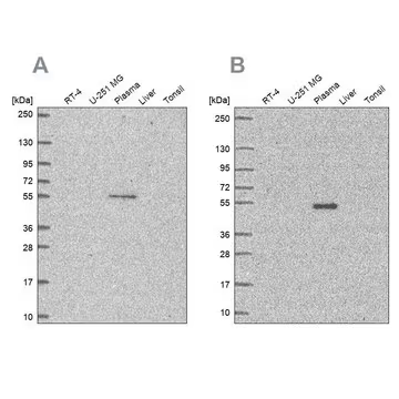 Anti-EED antibody produced in rabbit, 100 µL (HPA060089-100UL)