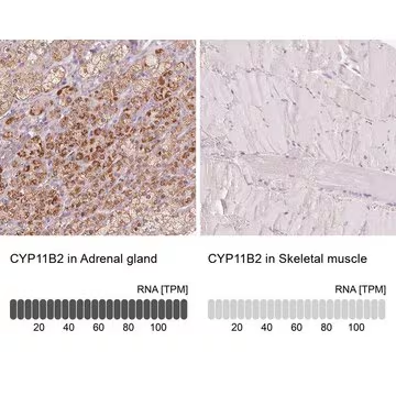 Anti-CYP11B2 antibody produced in rabbit, 100 µL (HPA057752-100UL)