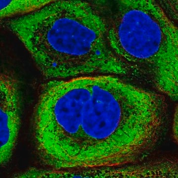 Anti-YBX1 antibody produced in rabbit, 100 µL (HPA057159-100UL)