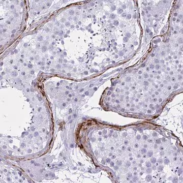 Anti-ELN antibody produced in rabbit, 1 X 100 µL (HPA056941-100UL)