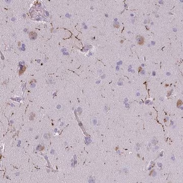 Anti-NPY antibody produced in rabbit, 100 µL (HPA056798-100UL)