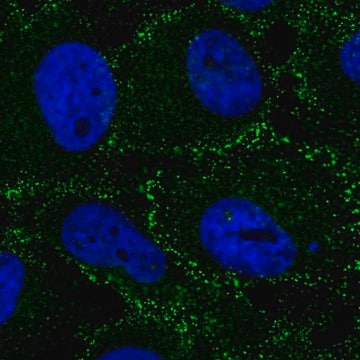 Anti-AP2B1 antibody produced in rabbit, 100 µL (HPA056733-100UL)