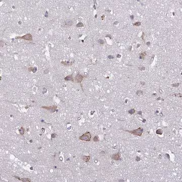 Anti-TMEM8C antibody produced in rabbit, 1 X 100 µL (HPA055785-100UL)