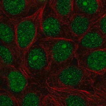 Anti-SPDEF antibody produced in rabbit, 100 µL (HPA055707-100UL)