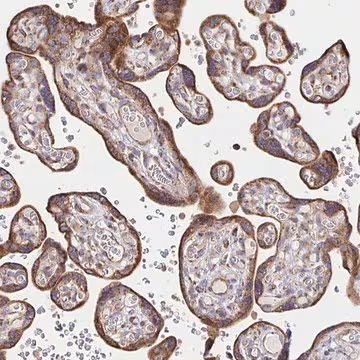 Anti-SAT1 antibody produced in rabbit, 100 µL (HPA055312-100UL)