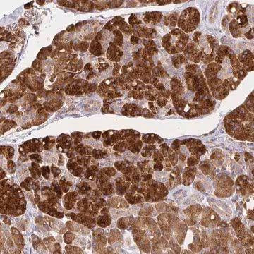 Anti-IRAK1 antibody produced in rabbit, 100 µL (HPA054476-100UL)