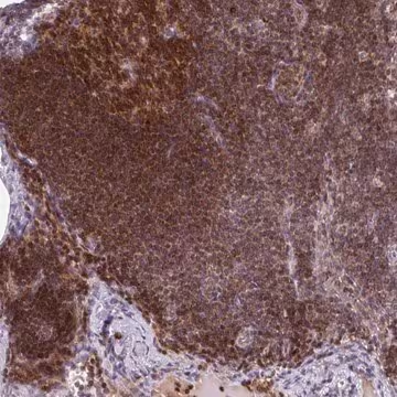 Anti-PRKCH antibody produced in rabbit, 100 µL (HPA053709-100UL)