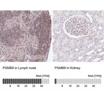 Anti-PSMB9 antibody produced in rabbit, 1 X 100 µL (HPA053280-100UL)