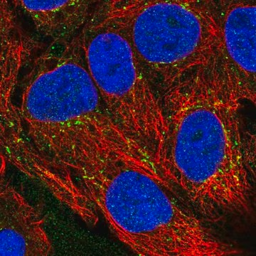 Anti-CXCL16 antibody produced in rabbit, 100 µL (HPA053253-100UL)