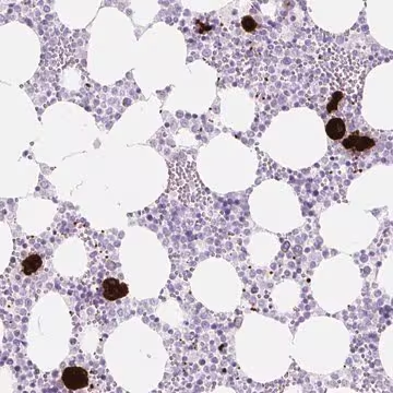 Anti-PF4 antibody produced in rabbit, 100 µL (HPA052485-100UL)