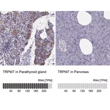 Anti-TRPM7 antibody produced in rabbit, 100 µL (HPA052173-100UL)