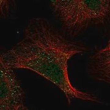 Anti-ADAMTS13 antibody produced in rabbit, 1 X 100 µL (HPA052077-100UL)