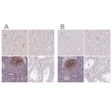 Anti-TMEM119 antibody produced in rabbit, 1 X 100 µL (HPA051870-100UL)