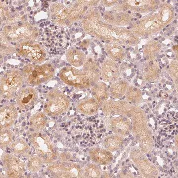 Anti-SLC34A1 antibody produced in rabbit, 1 X 100 µL (HPA051255-100UL)
