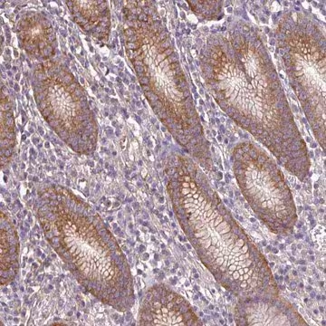 Anti-RP11-849H4.2 antibody produced in rabbit, 1 X 100 µL (HPA051121-100UL)