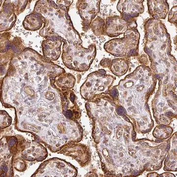 Anti-CNOT1 antibody produced in rabbit, 1 X 100 µL (HPA049664-100UL)