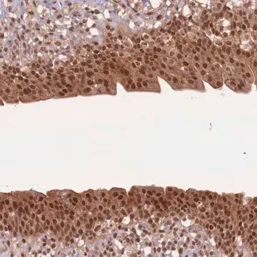 Anti-UBB antibody produced in rabbit, 100 µL (HPA049132-100UL)