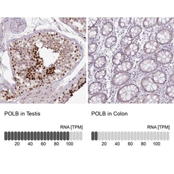 Anti-POLB antibody produced in rabbit, 100 µL (HPA049104-100UL)