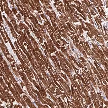 Anti-PDE4D antibody produced in rabbit, 1 X 100 µL (HPA045895-100UL)