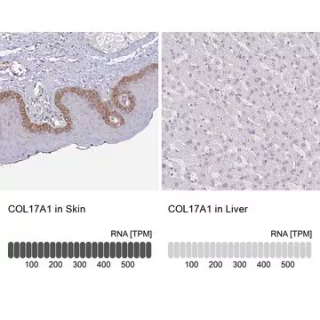 Anti-COL17A1 antibody produced in rabbit, 1 X 100 µL (HPA043673-100UL)