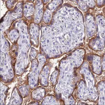 Anti-FGF7 antibody produced in rabbit, 1 X 100 µL (HPA043605-100UL)