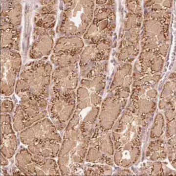 Anti-FUT8 antibody produced in rabbit, 1 X 100 µL (HPA043410-100UL)
