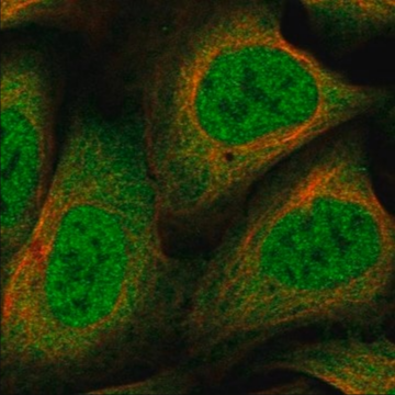 Anti-NCOR1 antibody produced in rabbit, 100 µL (HPA043246-100UL)