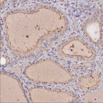 Anti-SLC26A4 antibody produced in rabbit, 1 X 100 µL (HPA042860-100UL)