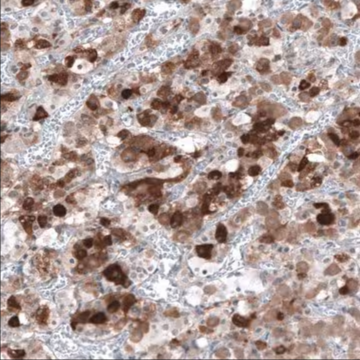 Anti-TSHB antibody produced in rabbit, 100 µL (HPA042681-100UL)