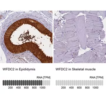 Anti-WFDC2 antibody produced in rabbit, 1 X 100 µL (HPA042302-100UL)
