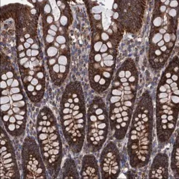 Anti-C14orf159 antibody produced in rabbit, 1 X 100 µL (HPA041423-100UL)