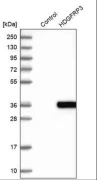 Anti-RP11-382A20.3 antibody produced in rabbit, 1 X 100 µL (HPA040719-100UL)