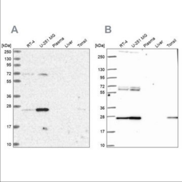 Anti-TFAM antibody produced in rabbit, 1 X 100 µL (HPA040648-100UL)