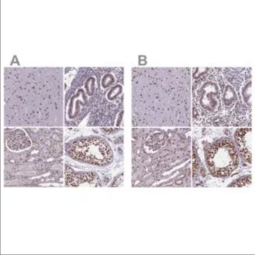 Anti-MPHOSPH8 antibody produced in rabbit, 1 X 100 µL (HPA040035-100UL)