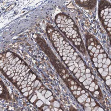 Anti-TBCK antibody produced in rabbit, 1 X 100 µL (HPA039951-100UL)