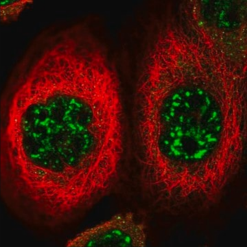 Anti-FOXO4 antibody produced in rabbit, 100 µL (HPA039560-100UL)