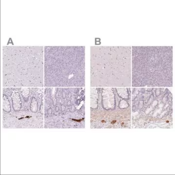Anti-PRPH antibody produced in rabbit, 100 µL (HPA039277-100UL)