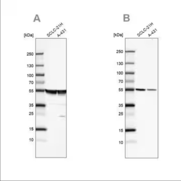 Anti-TUBA1A antibody produced in rabbit, 100 µL (HPA039247-100UL)