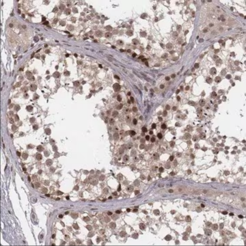 Anti-HMGA2 antibody produced in rabbit, 100 µL (HPA039076-100UL)