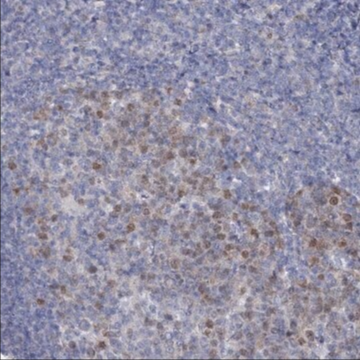 Anti-FAM111B antibody produced in rabbit, 1 X 100 µL (HPA038637-100UL)