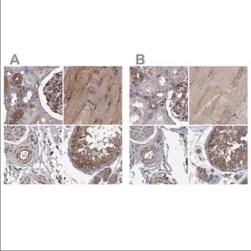 Anti-MAP4 antibody produced in rabbit, 1 X 100 µL (HPA038149-100UL)