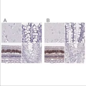 Anti-CRX antibody produced in rabbit, 1 X 100 µL (HPA036762-100UL)
