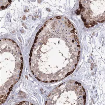 Anti-STT3B antibody produced in rabbit, 1 X 100 µL (HPA036646-100UL)