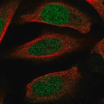 Anti-ECT2 antibody produced in rabbit, 100 µL (HPA036363-100UL)