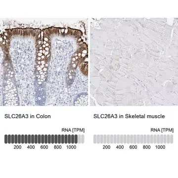 Anti-SLC26A3 antibody produced in rabbit, 1 X 100 µL (HPA036055-100UL)