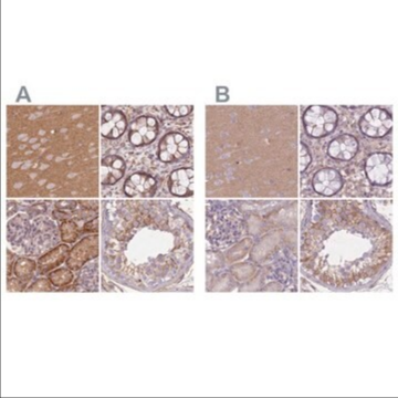 Anti-ADD1 antibody produced in rabbit, 100 µL (HPA035873-100UL)