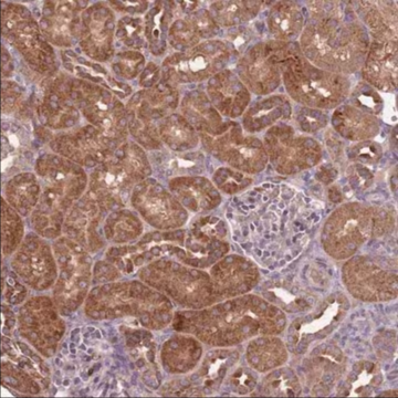 Anti-IGF2BP2 antibody produced in rabbit, 1 X 100 µL (HPA035145-100UL)