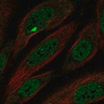 Anti-MCPH1 antibody produced in rabbit, 1 X 100 µL (HPA012064-100UL)